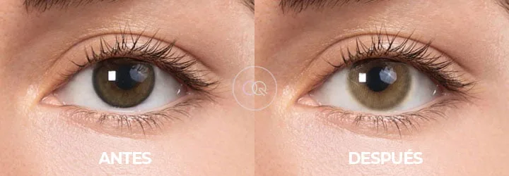 Crooma Antes y Después